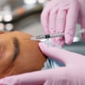 Discover Reiki and Non-Surgical Aesthetic Benefits in Woodland Hills